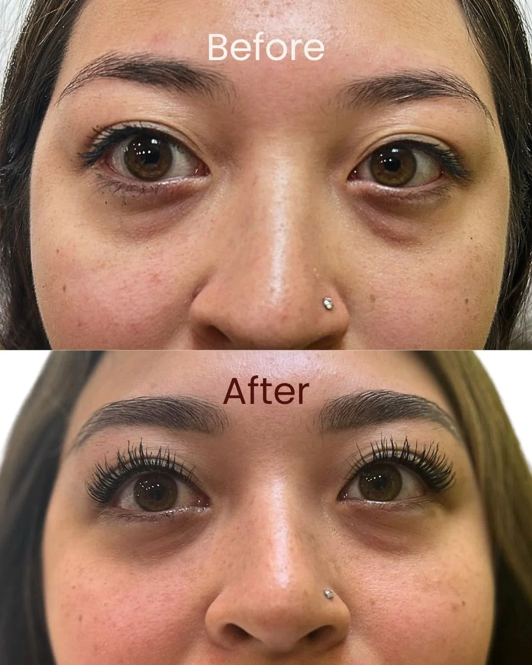 Close-up of a woman's face before and after her eyebrow ombre or powder treatment, showing significant improvement in definition and structure.