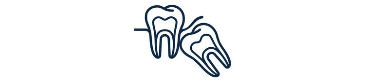 Wisdom Teeth Removal and Dental Extractions, AWOMS, Albury, Griffith, Wagga Wagga, Wangaratta