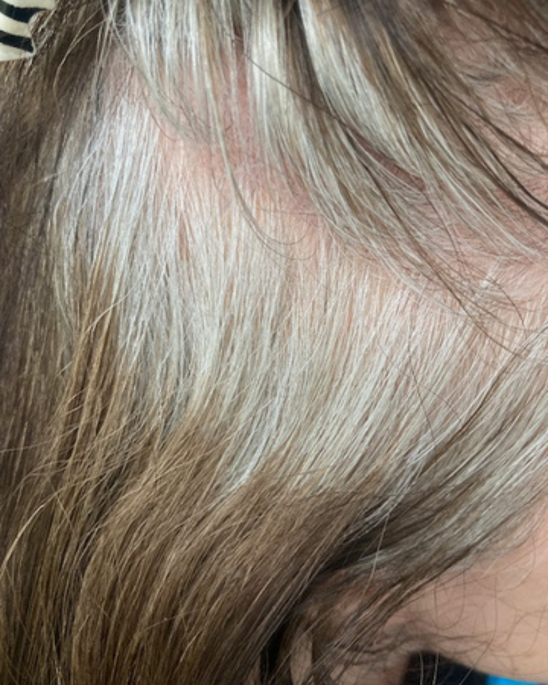 WHAT IS GREY BLENDING?