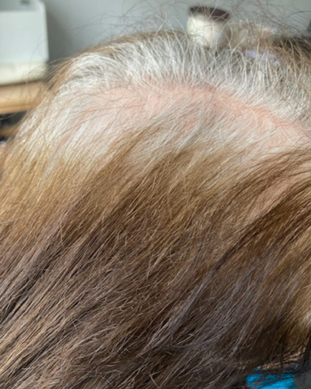 Bespoke grey blending colour journey tailored to natural hair patterns and tones