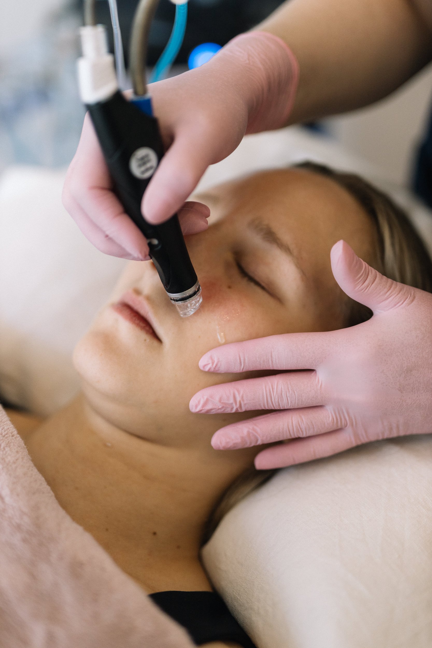 Henkilö saa Hydrafacial hoitoa kosmetologilta kauneushoitolassa Tampereen keskustassa. Kosmetologi Jaana käyttää pientä hoitokynää hoitotoimenpiteessä. Potilas makaa sängyllä silmät kiinni.
