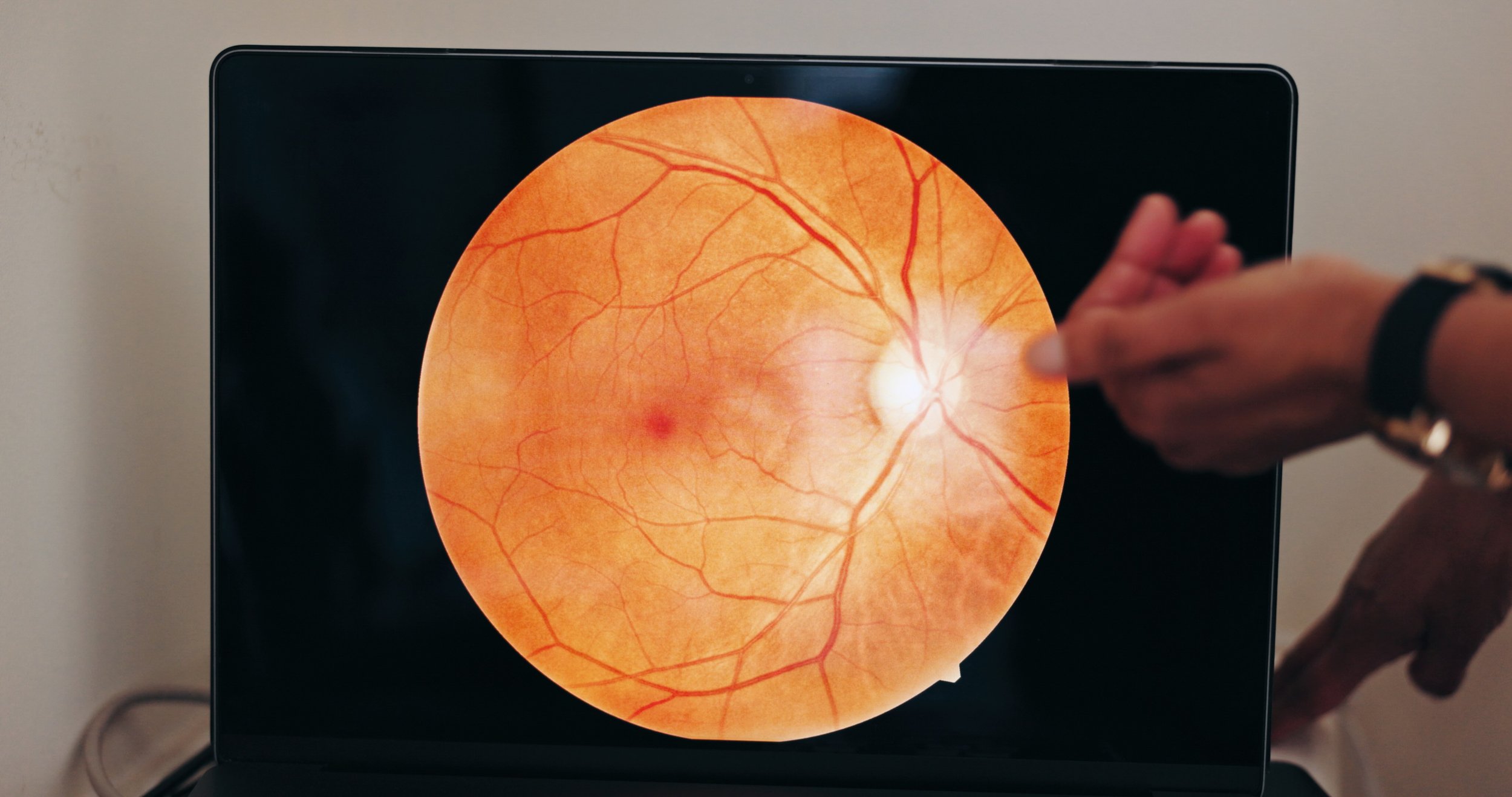An illustration of the human retina displayed on a screen, showing blood vessels, the optic nerve, and the macula.