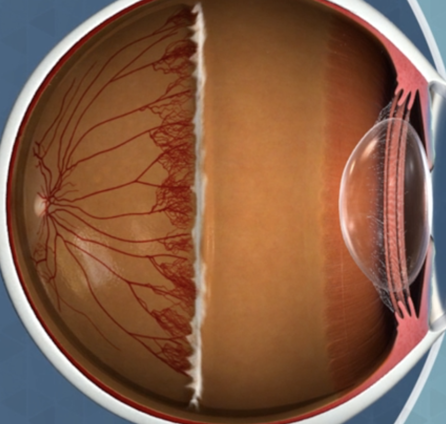 A detailed cross-section of a human eye, showing the retina, blood vessels, and the lens.