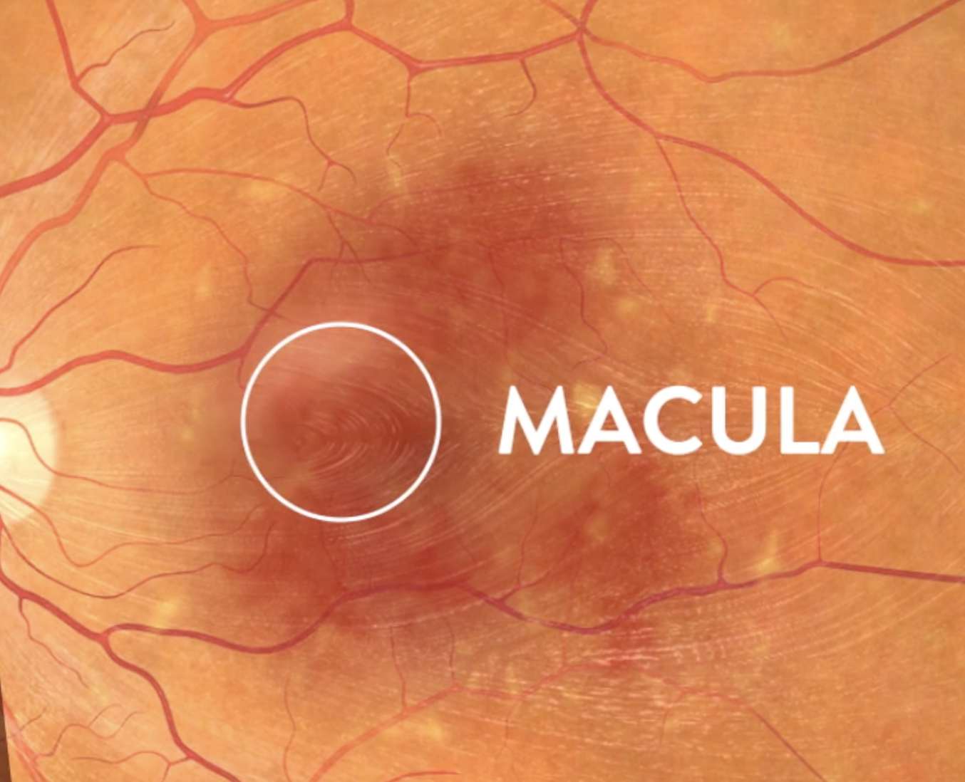 Close-up of an eye retina with the macula labeled and highlighted with a white circle.
