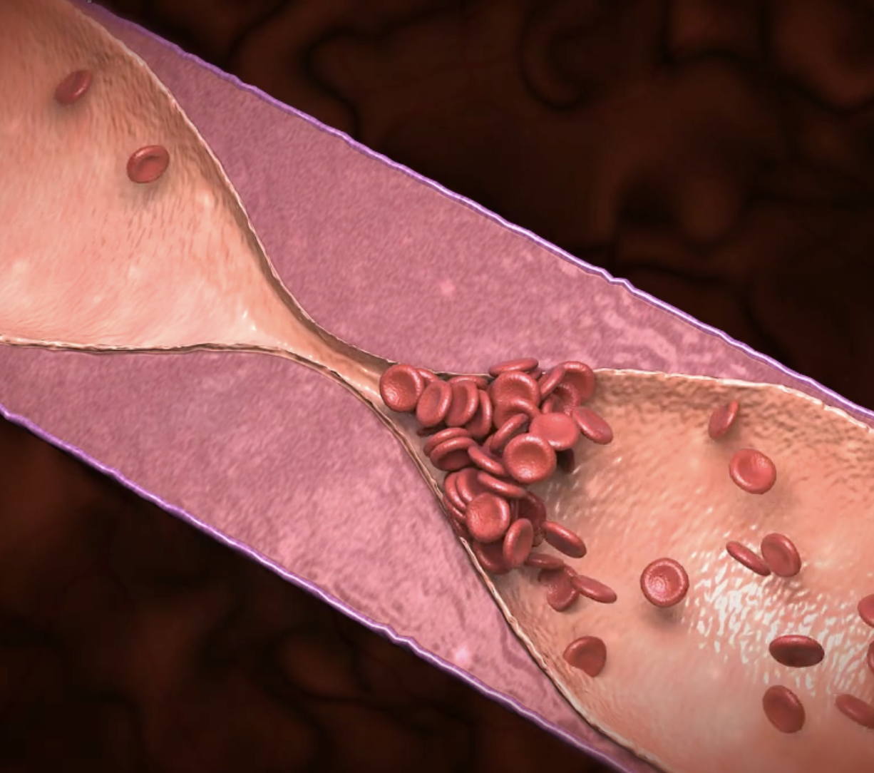 A digital illustration of a blood vessel with red blood cells flowing through.