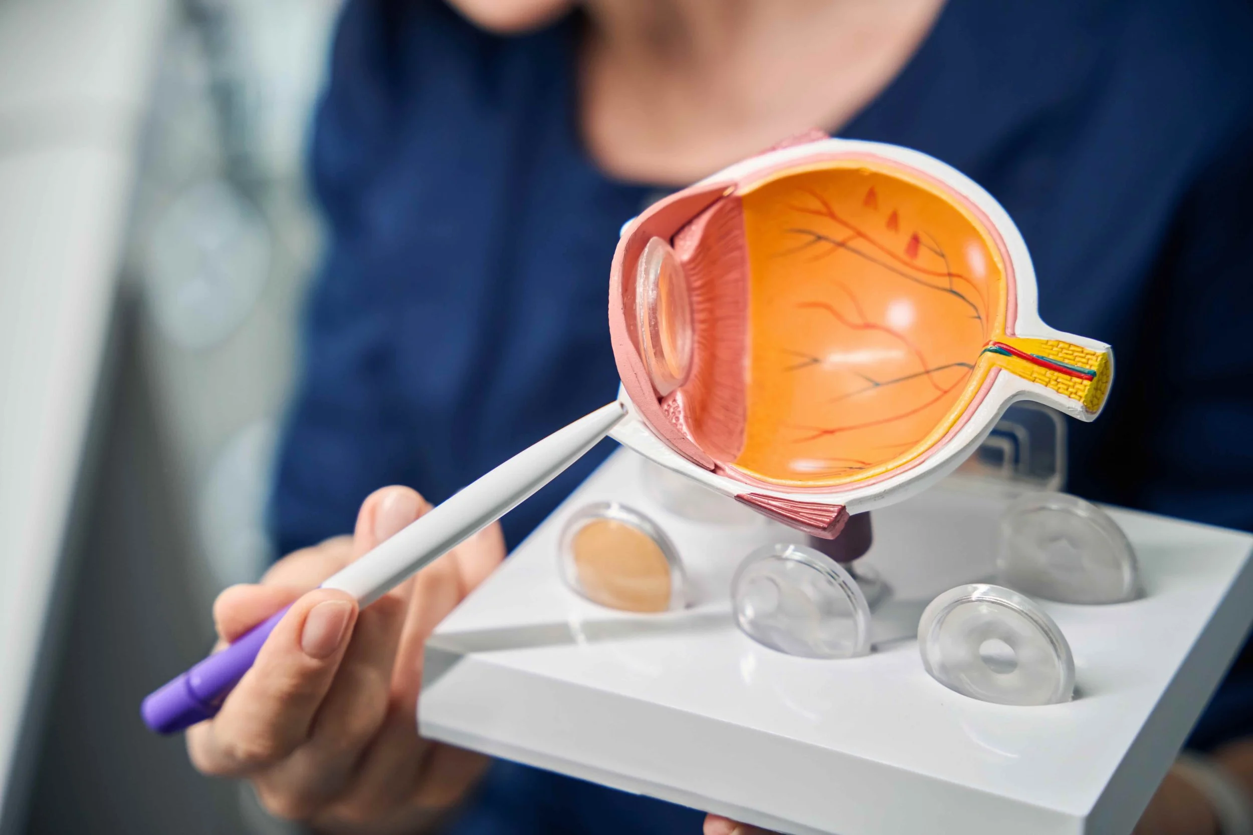 A person holding a detailed anatomical model of an eye with a purple pen, with a white stand holding small glass slides in the background.