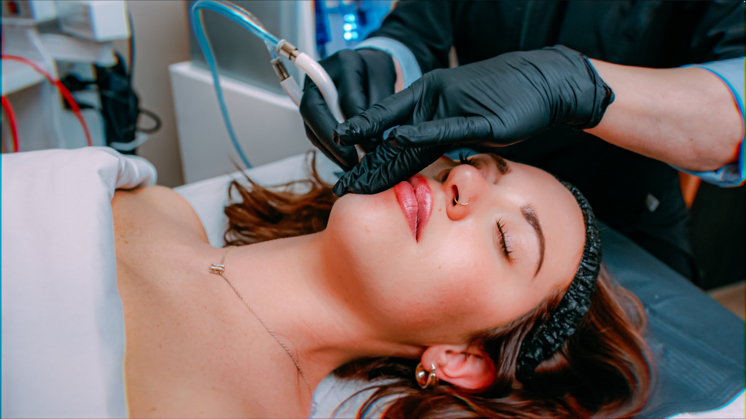 Which Facial Treatment Best Addresses Your Skin Goals in Rock Island, IL
