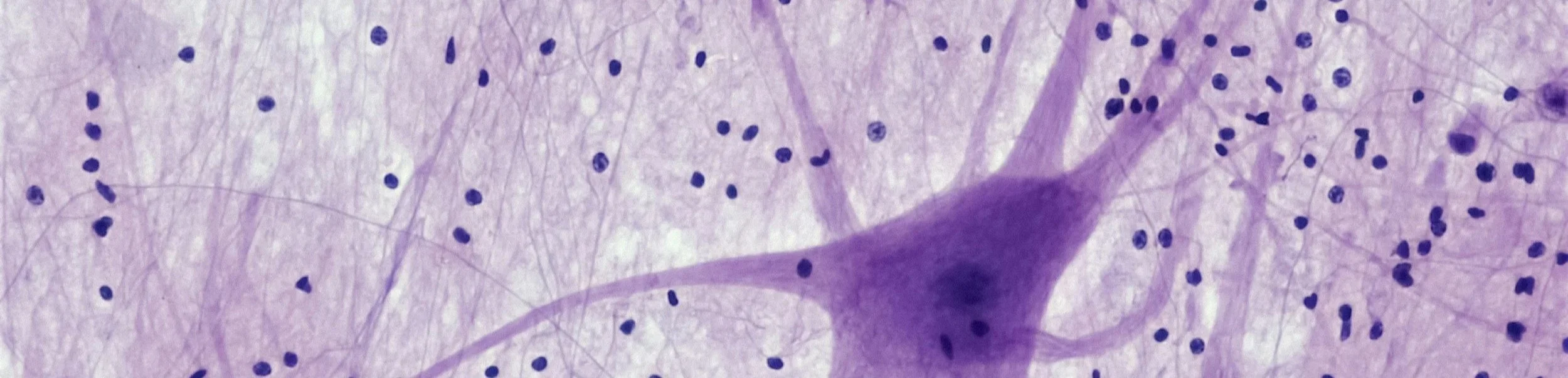 Up close image of neurons