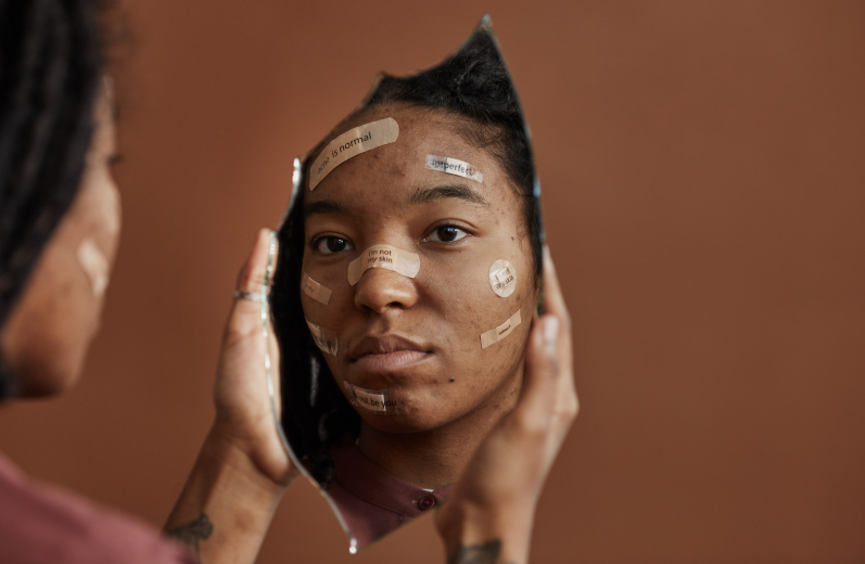 Therapy for self-esteem, self-criticism, confidence, and emotional wellbeing