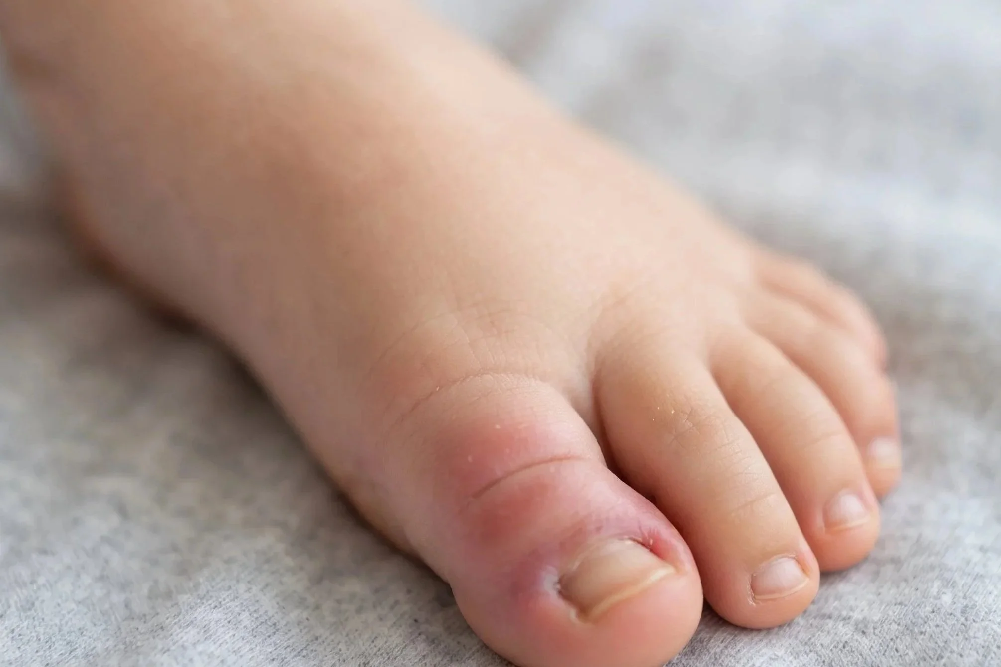 Close-up of a baby's hand resting on a soft surface.