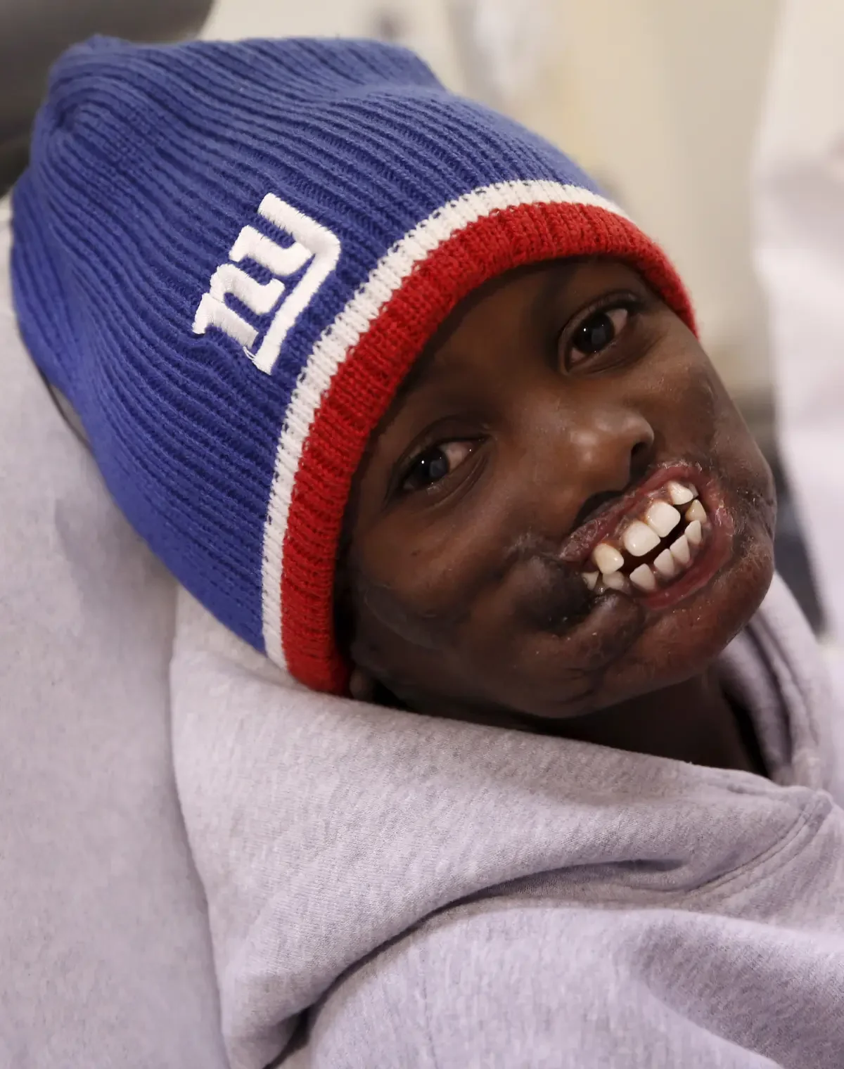 Long Island Wrestling Star Overcomes Near Death Experience