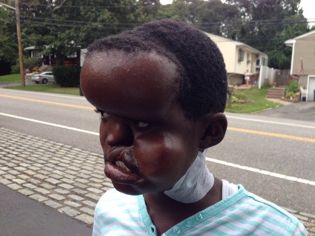 Teen girl heads back to Kenya after life-changing surgeries on Long Island