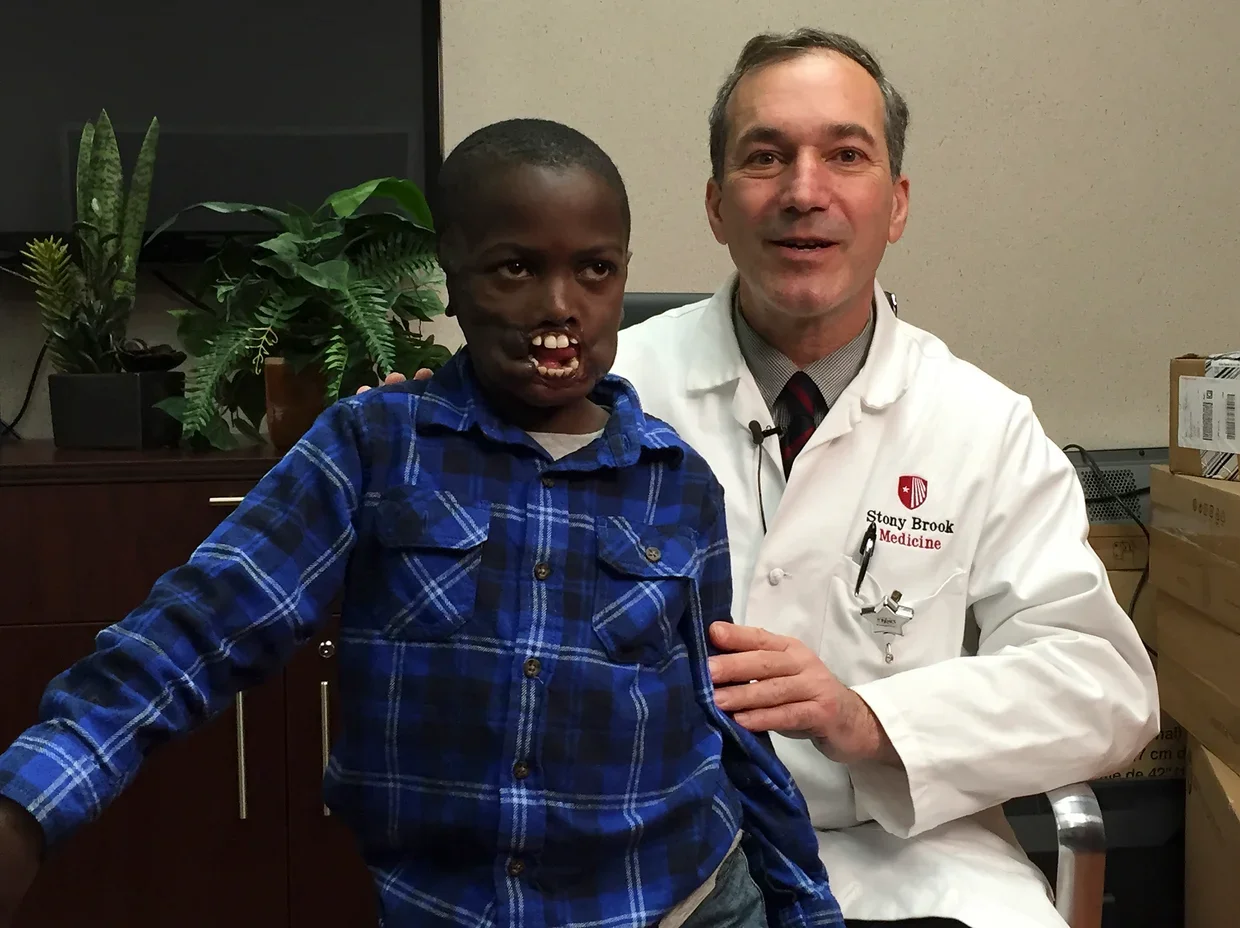 Boy mauled by chimp in Congo to get facial reconstruction surgery