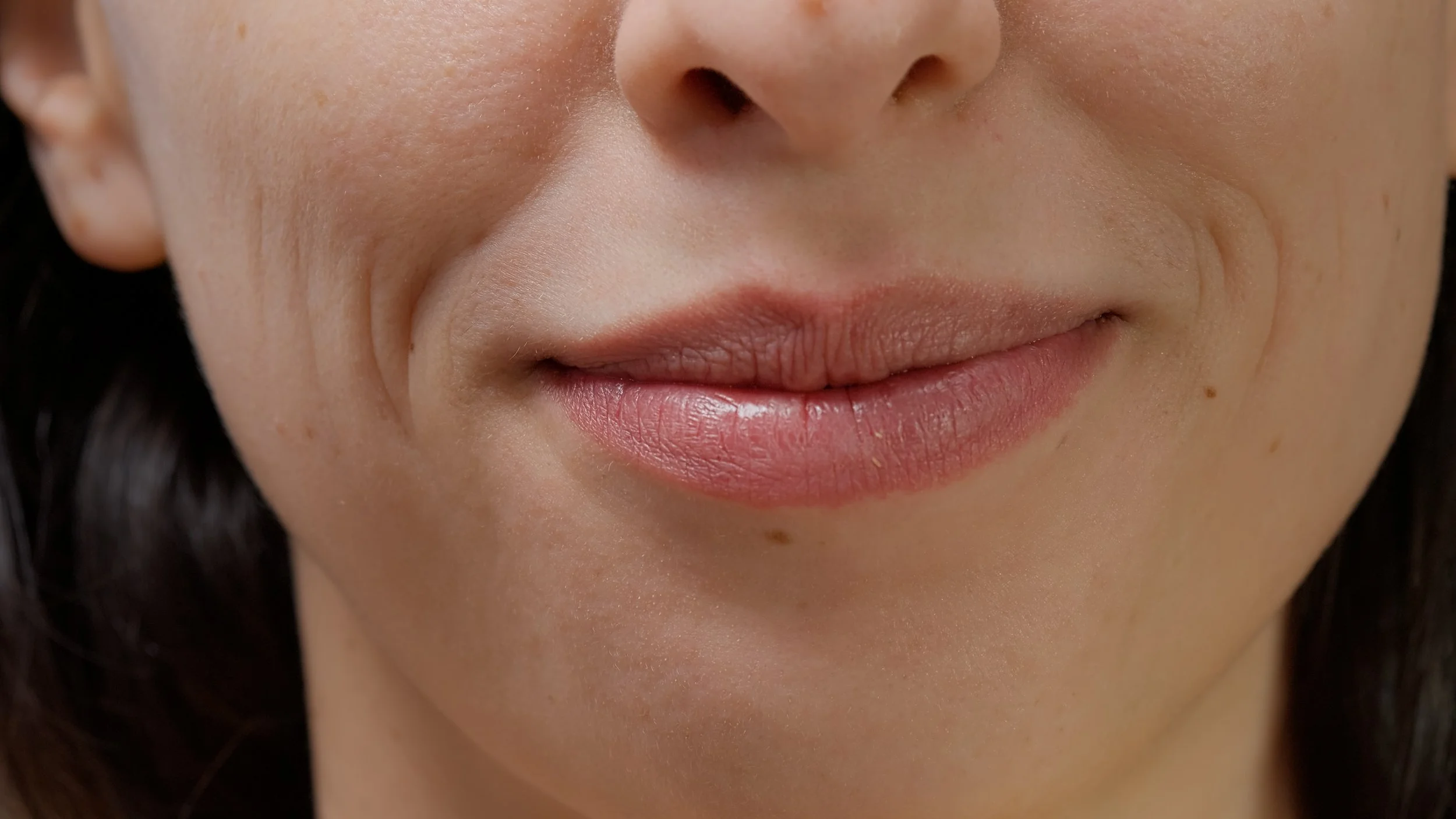 Synergy Aesthetics Sonoma | Medspa in Sonoma, CA, 95476 | Fotona LipLase® near me.jpg