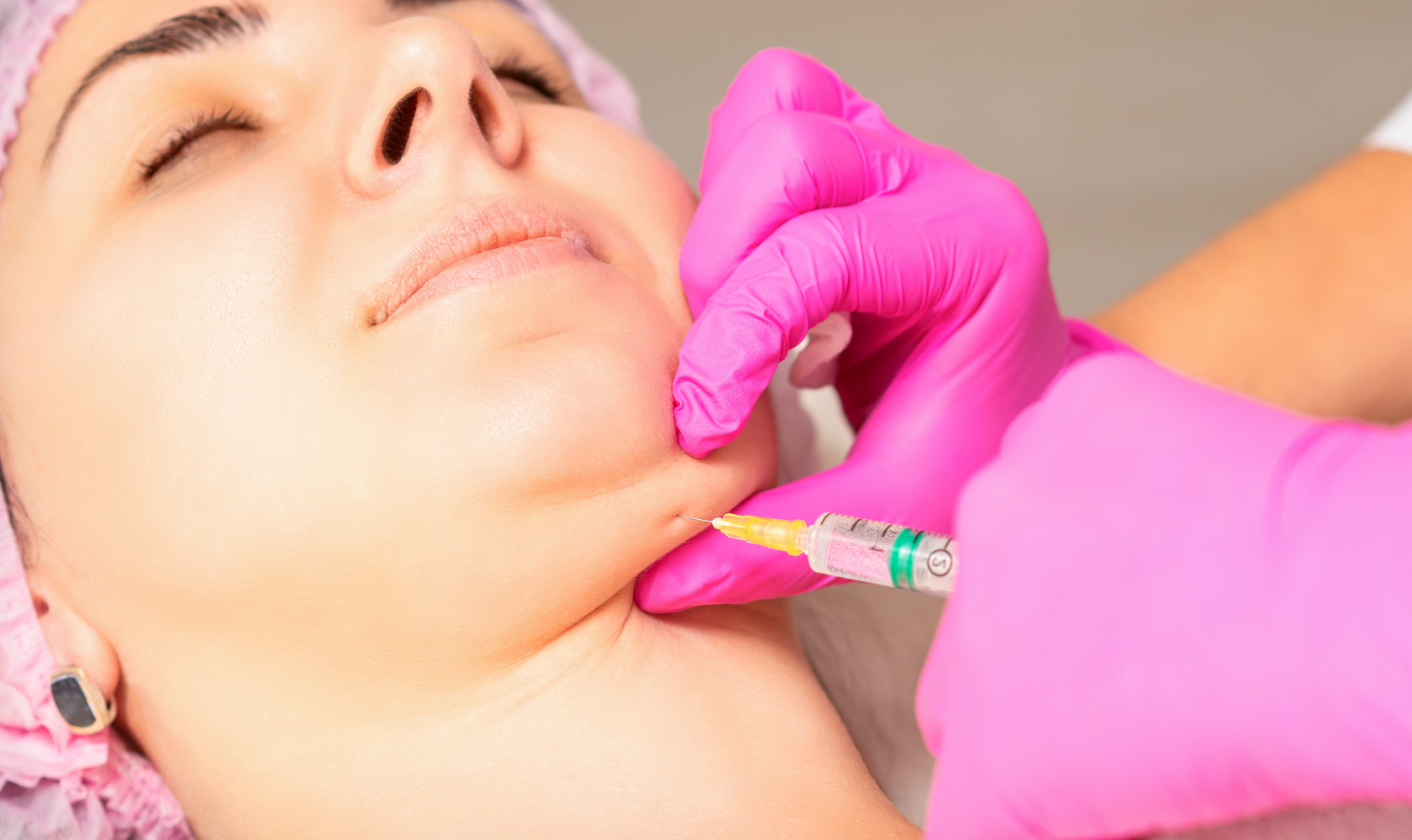 KYBELLA® | Medspa in Sonoma, CA, 95476 |  Near Me