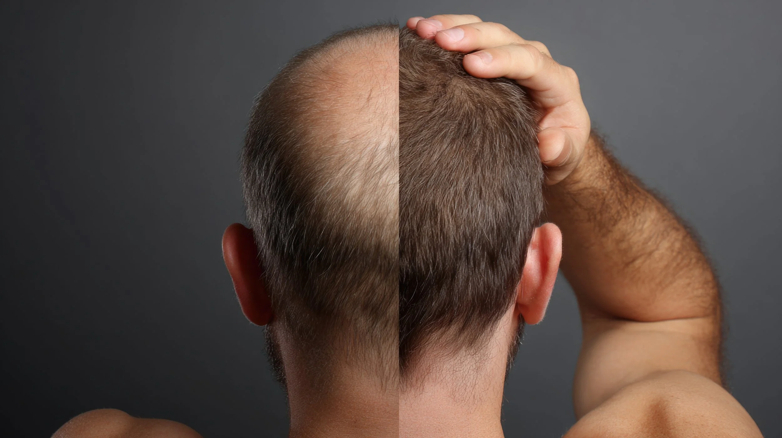 Synergy Aesthetics Sonoma | Medspa in Sonoma, CA, 95476 | Hair Regrowth Therapy near me.jpg