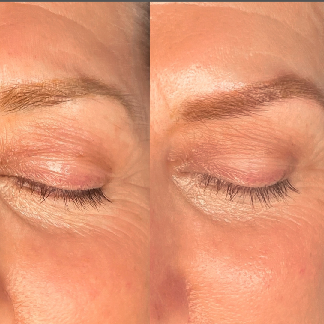 Before and after eyebrow colour correction treatment by ENA Aesthetics in Melbourne, correcting faded cosmetic tattoo pigment and improving brow shape.