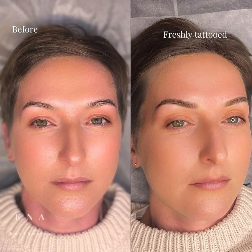 Soft, natural eyebrow tattooing

This transformation is all about creating better definition and balance while keeping the brows natural and suited to the client’s individual features.

Using a soft powder eyebrow tattoo technique, we refined the sha