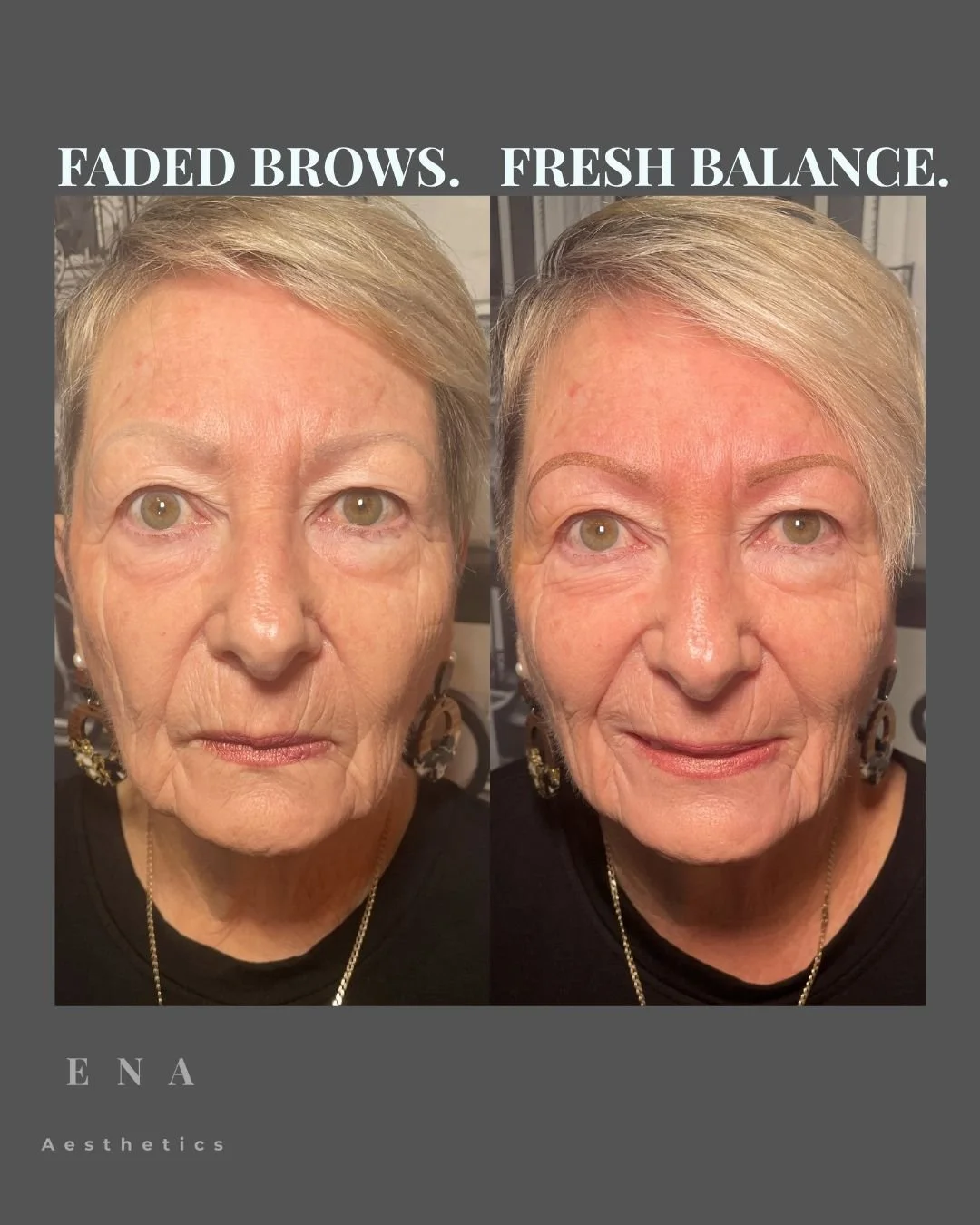 Before and after cosmetic eyebrow tattoo treatment showing how Soft Powder Brows can beautifully frame the face, restore balance and create elegant, natural-looking definition on mature skin.