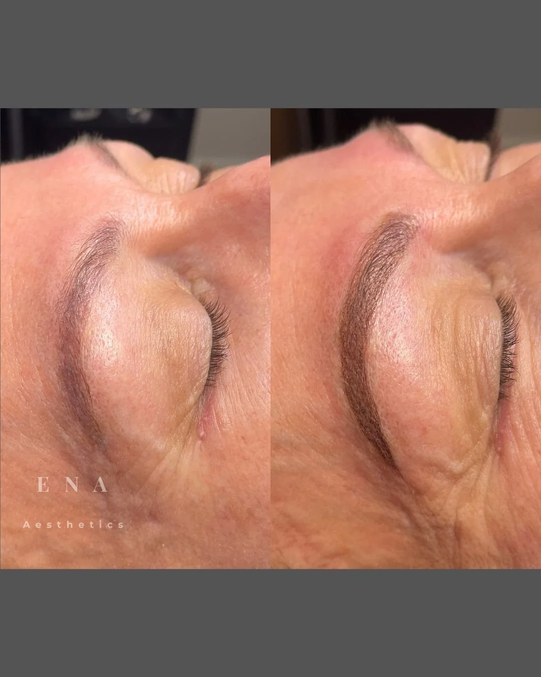 Professional eyebrow colour correction designed to improve colour, shape and overall facial harmony, creating elegant, natural-looking brows without the need for complete removal.