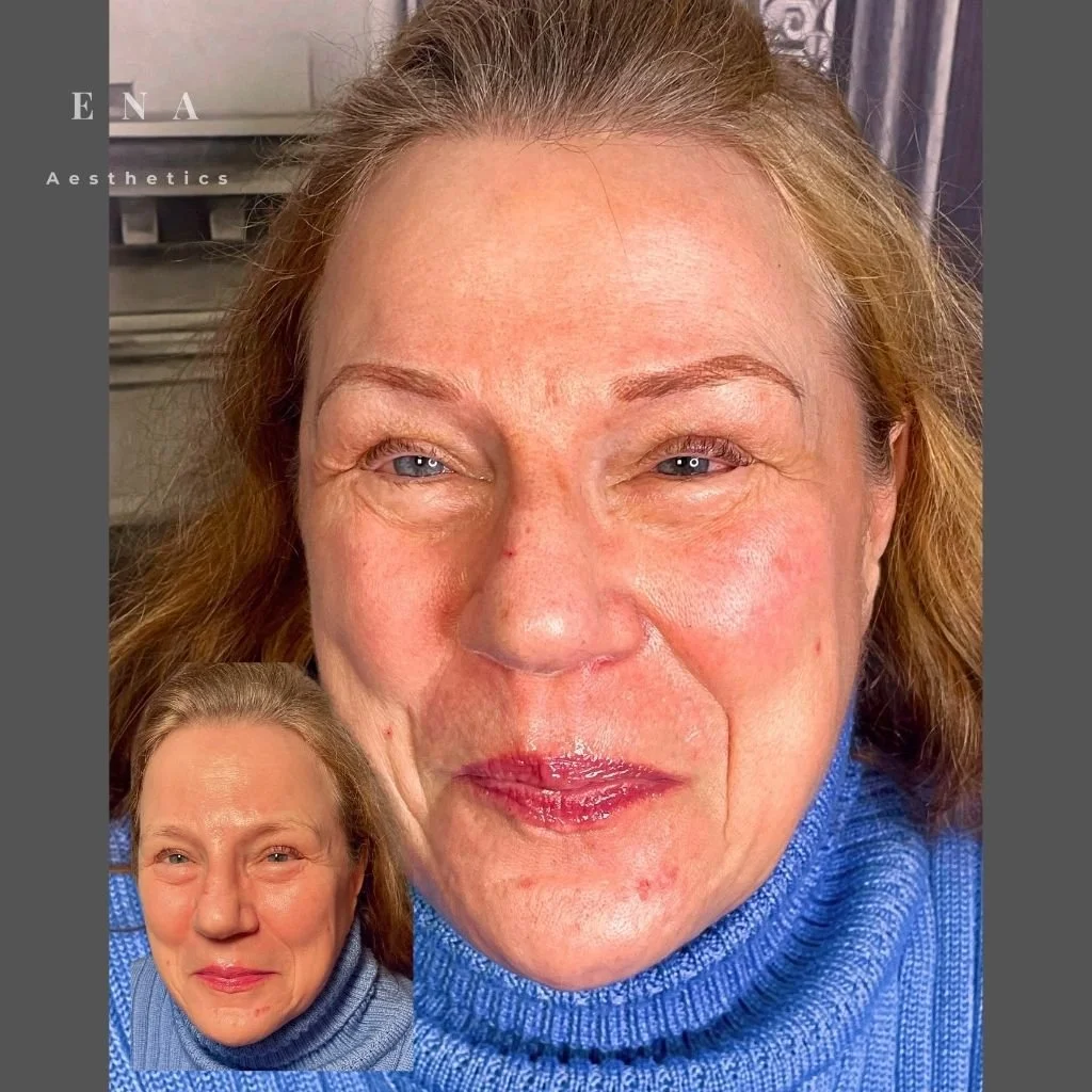 Natural eyebrow tattooing for mature skin 🤍

Age doesn’t mean you have to give up on beautifully defined, natural-looking brows.

For mature skin, the right shape, colour and tattooing technique are especially important. In this case, the goal was t