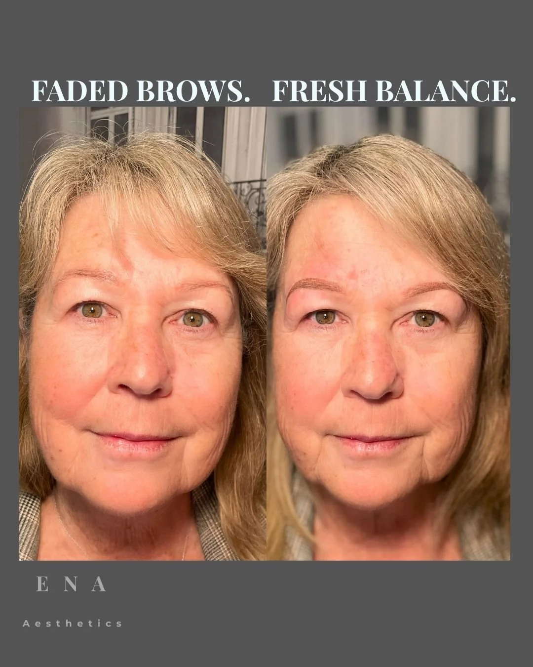 Before and after Soft Powder Brows treatment demonstrating how natural-looking eyebrow tattooing can restore facial harmony, softly frame the eyes and create elegant definition on mature skin.
