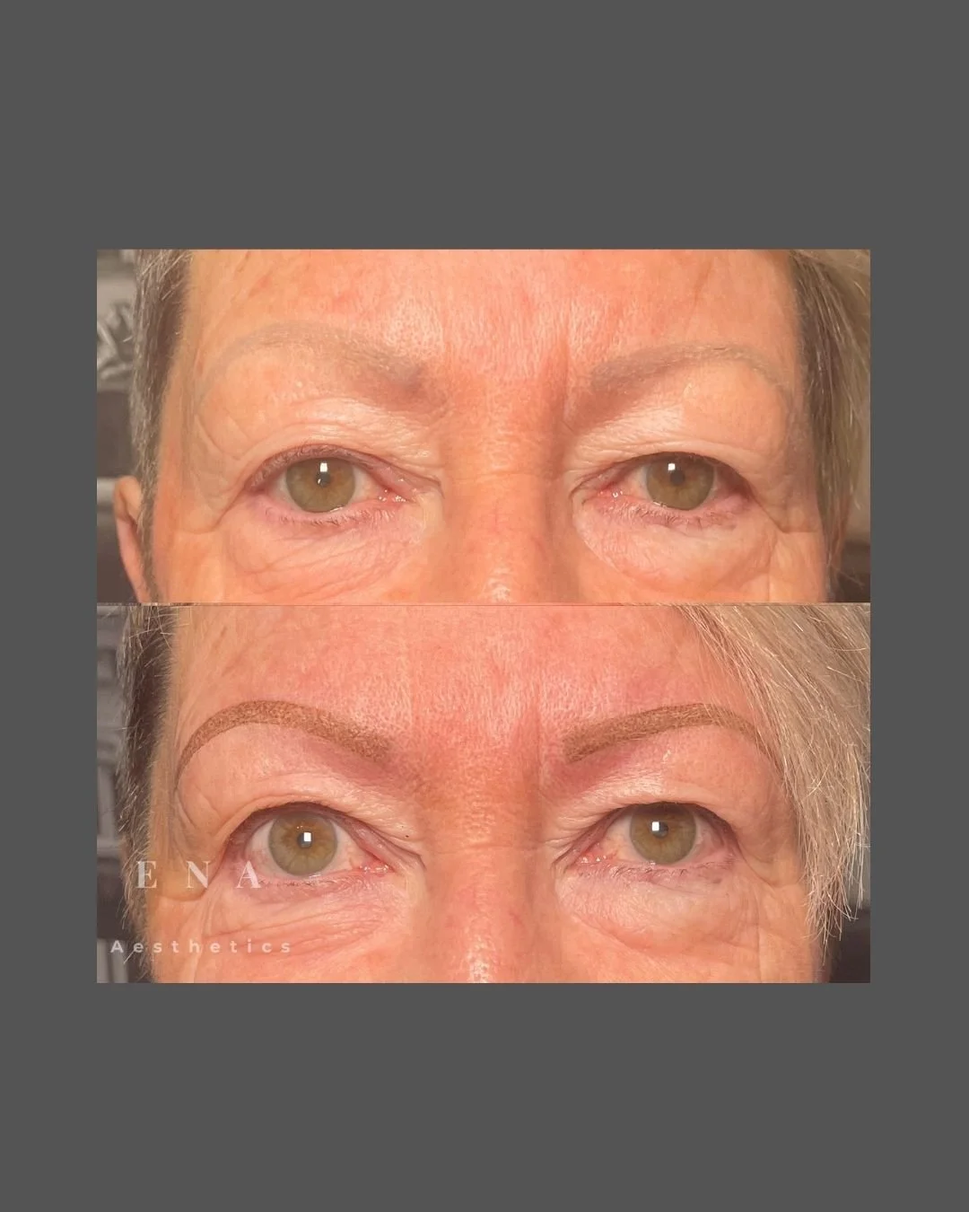 Before and after cosmetic eyebrow tattoo treatment showing how Soft Powder Brows can restore shape, definition and balance while maintaining a natural appearance.
