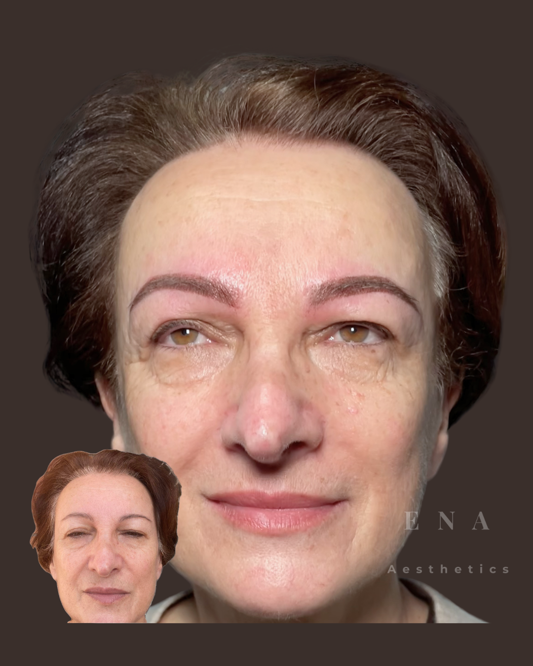 Before and after Soft Powder Brow cosmetic tattoo treatment by ENA Aesthetics in Melbourne, creating a more balanced and natural-looking eyebrow shape.