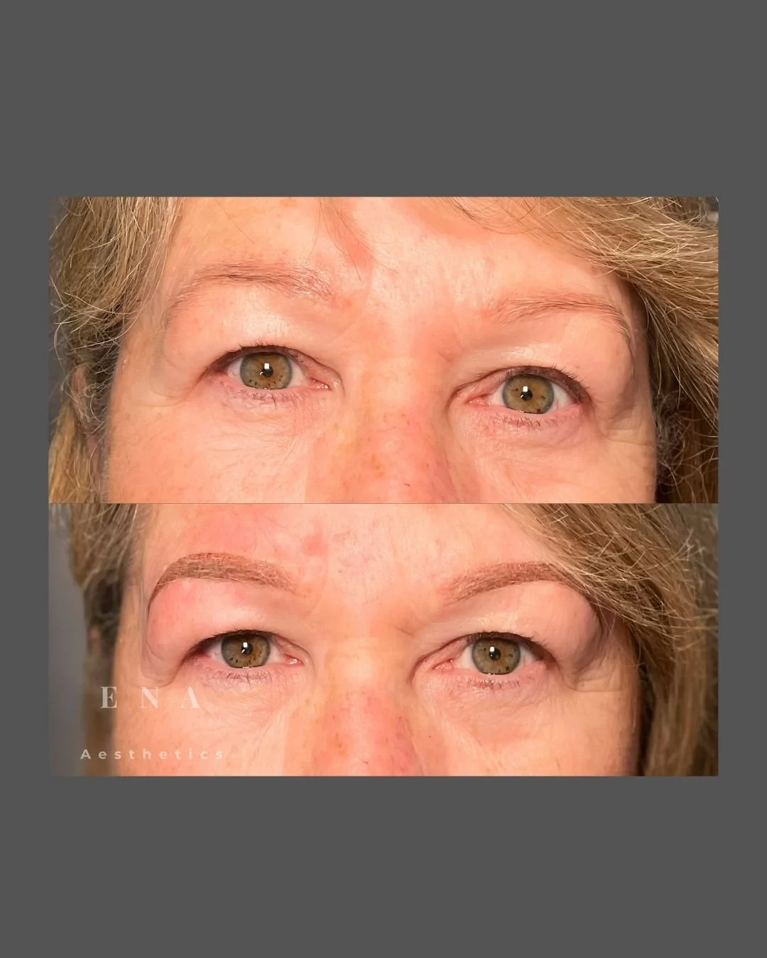 Before and after Soft Powder Brows treatment demonstrating how carefully designed brows can restore facial harmony and softly frame the eyes. A detailed consultation and personalised brow mapping process are key to achieving natural-looking results o