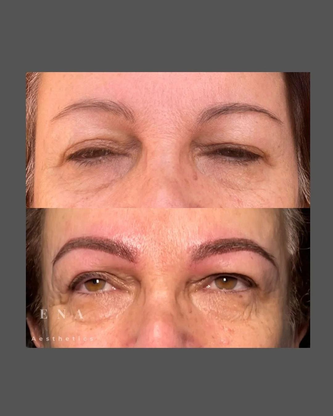 Before and after Soft Powder Brows treatment by ENA Aesthetics in Melbourne, creating soft, natural-looking brows designed to complement the client's facial features.