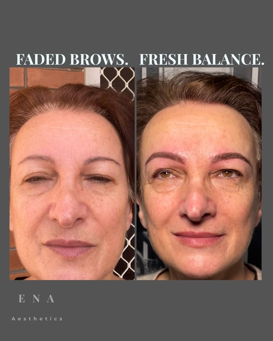 Before and after cosmetic eyebrow tattoo treatment showing how carefully designed Soft Powder Brows can restore shape, improve facial balance and create a naturally refreshed appearance.
