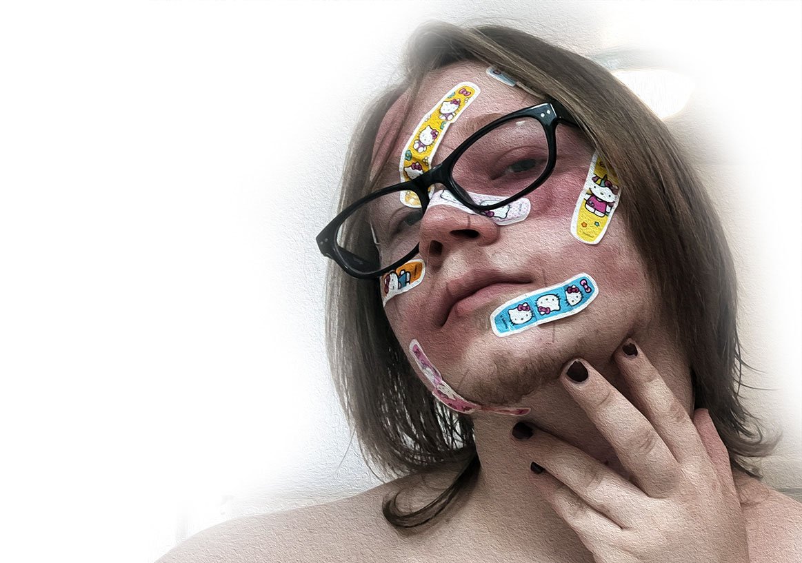 The reason the bandaids were on the subjects face in the first place was to cover wounds and injuries; the bright cutesy art contrasted with the violence they cover. However, I didn't know how to do faux-injury makeup, so I tried mocking it up in pho