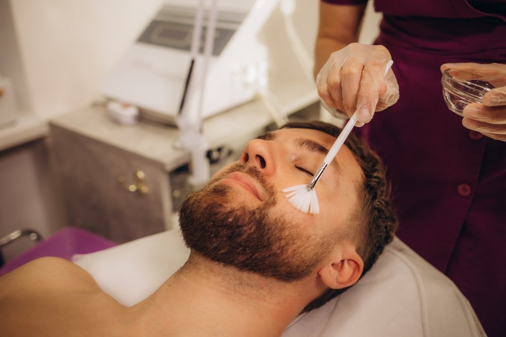 man getting a chemical peel facial