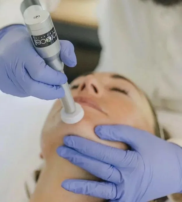 A person receiving a ProCell microchanneling treatment with a handheld device while lying down, with two gloved hands holding the device and supporting the face.
