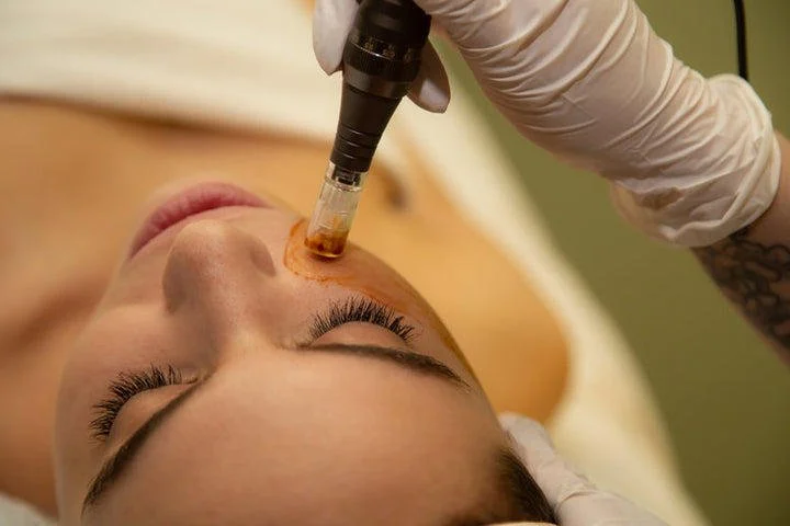 A person receiving a facial injection in their forehead, with a healthcare professional wearing gloves administering the treatment.