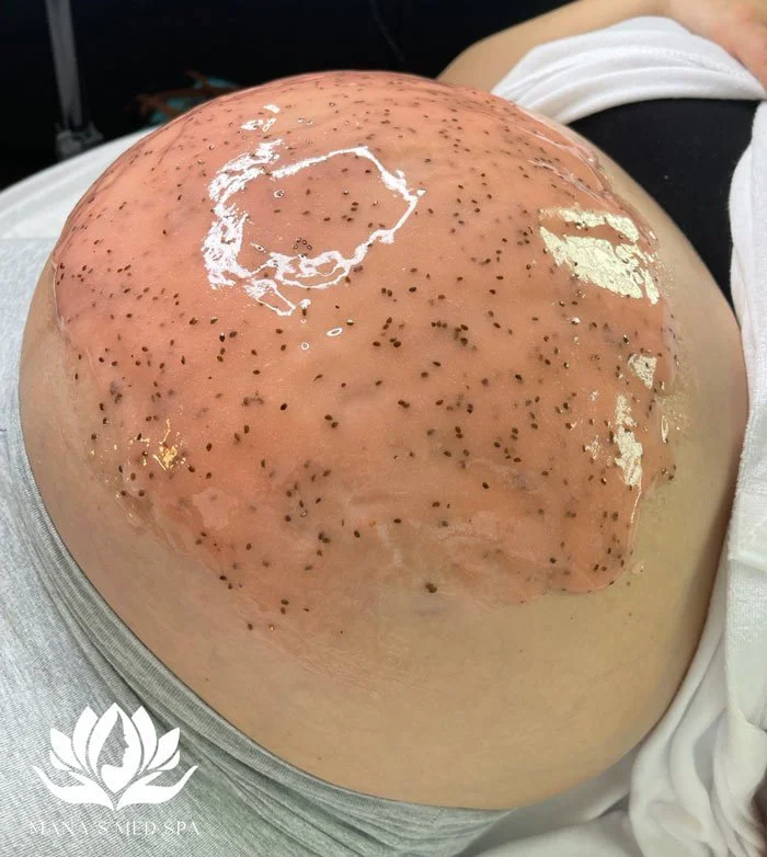 pregnant-belly-facial-manas-med-spa.jpg