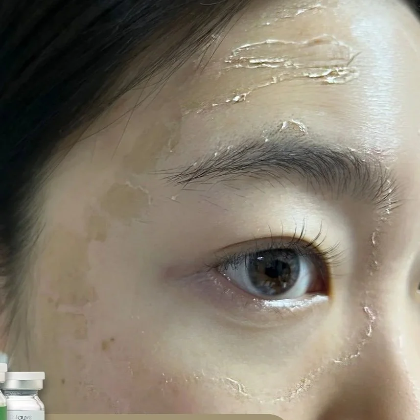 STAYVE+PEEL.jpg