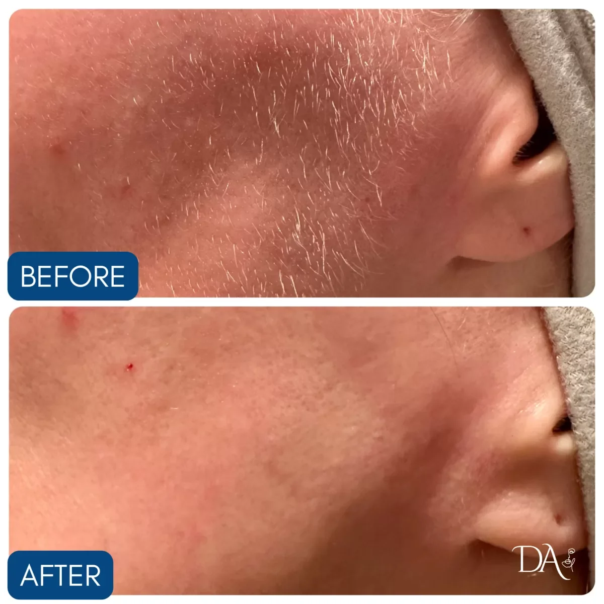 before&after3tsl.webp