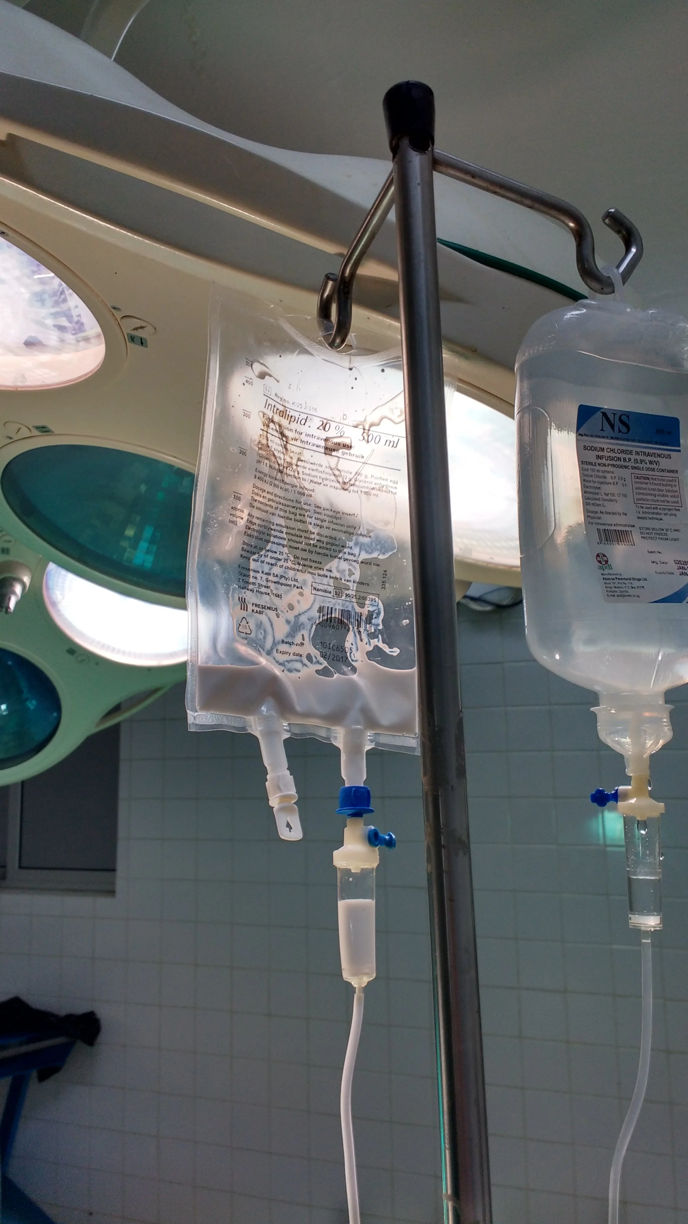 IV fluid bag and saline infusion bottles hanging from an IV pole in a hospital setting.