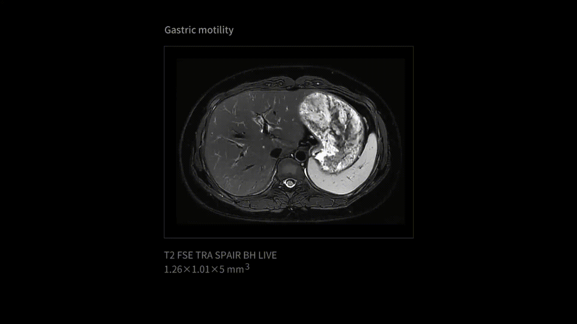 p8.gif