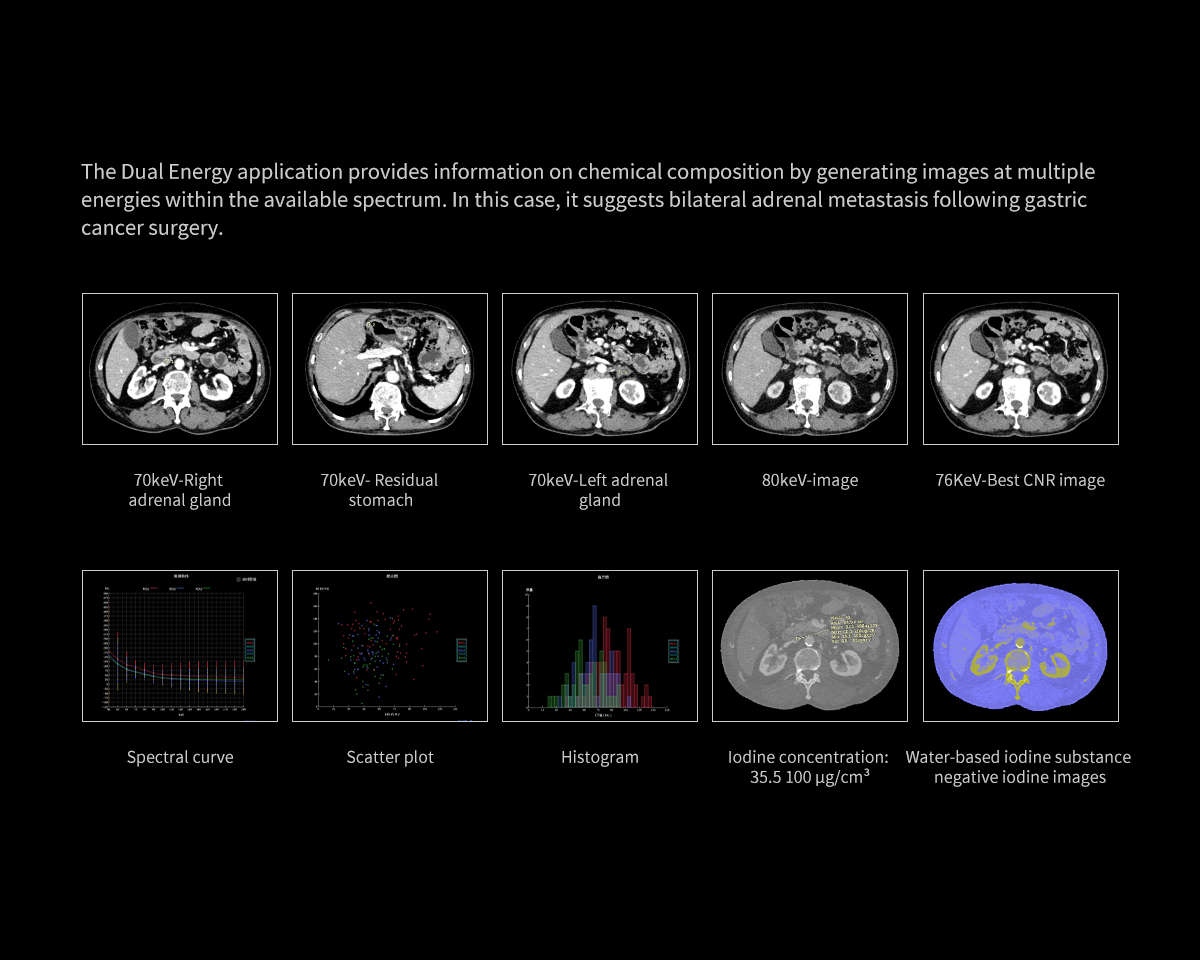 p38.png