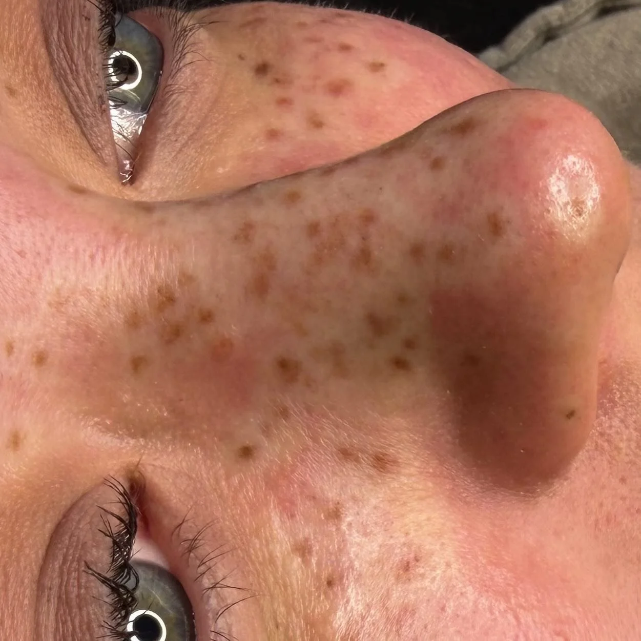 Close-up of some fresh freckles! ✨🤎

One of my favorite parts about tattooing freckles is creating all the different sizes, shapes, and patterns. No two freckles are exactly the same- just like snowflakes. ❄️

Each set is completely unique to the pe