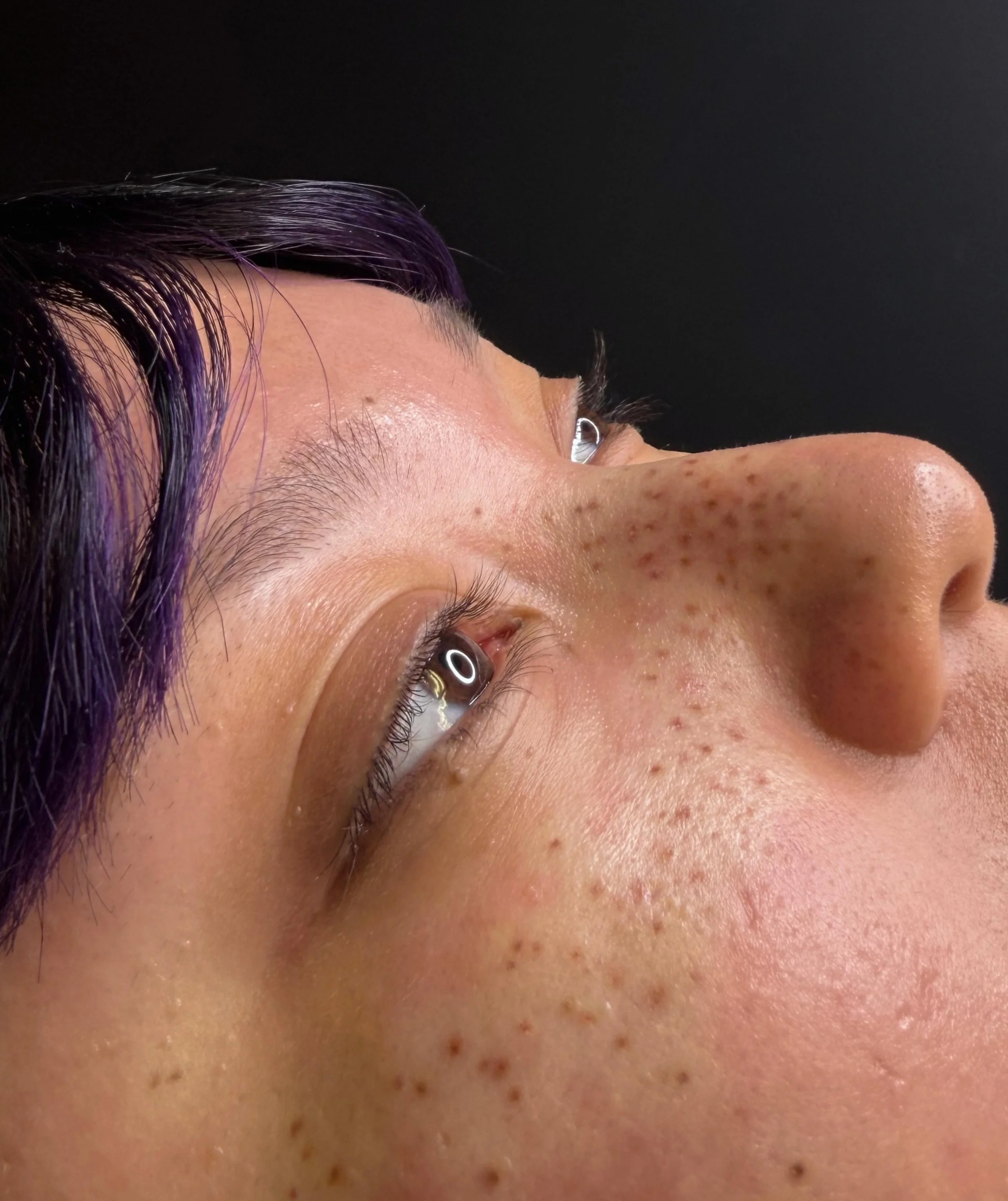 Fresh freckles are always a fun phase of the process! 
A little sun-kissed softness, a little magic, and somehow they already look like they&rsquo;ve always belonged there.

These will heal lighter and softer over the next few weeks 💗

If you&rsquo;