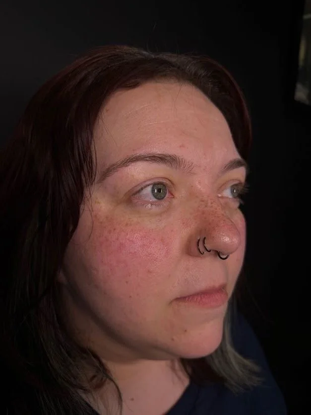 permanent-freckle-tattoo-michigan-city-IN.jpg