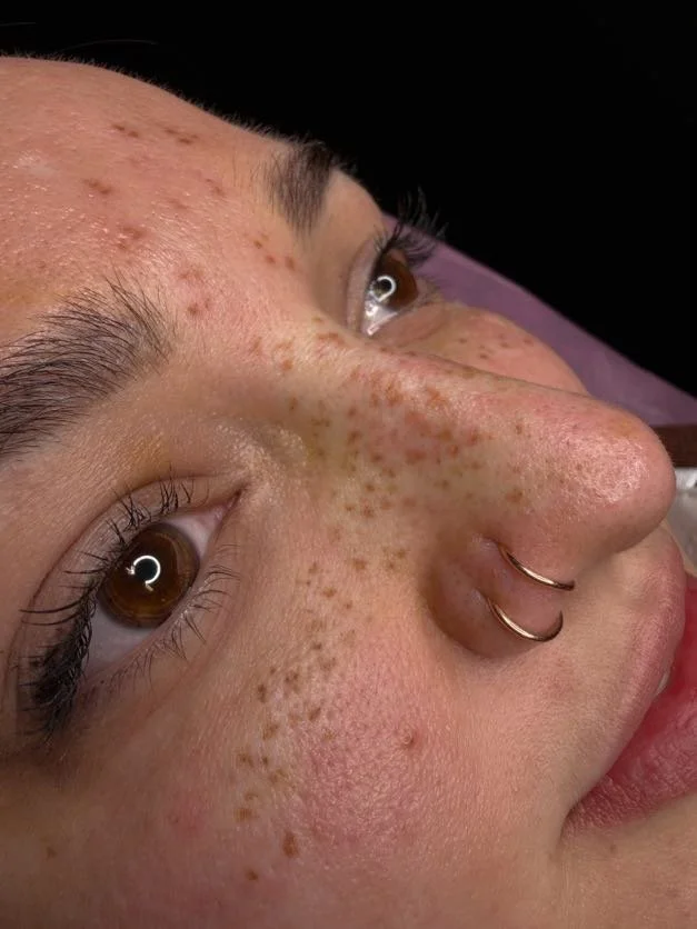 Close-up side view of a woman's face showing her brown eyes, freckles, pierced nose with two hoops, and a portion of her lips.