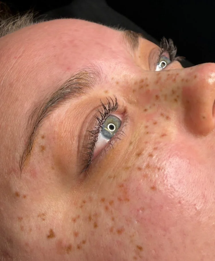 Close-up of a person's face showing tattooed freckles, blue eyes, long eyelashes, and eyebrows.