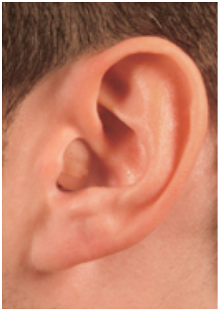 Close-up of a human ear with visible inner ear details.