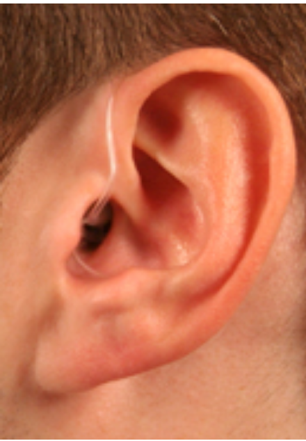 Close-up of a person's right ear and surrounding area.