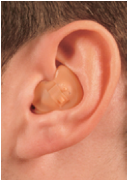 Close-up of a person's ear with a beige hearing aid inside the ear canal.