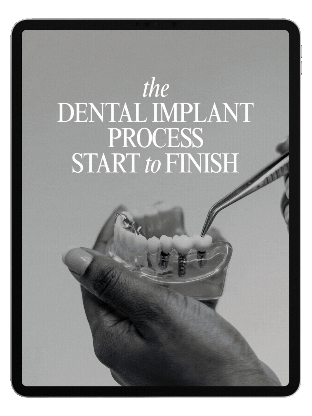 Tablet screen displaying an image of a dental templates scrolling.